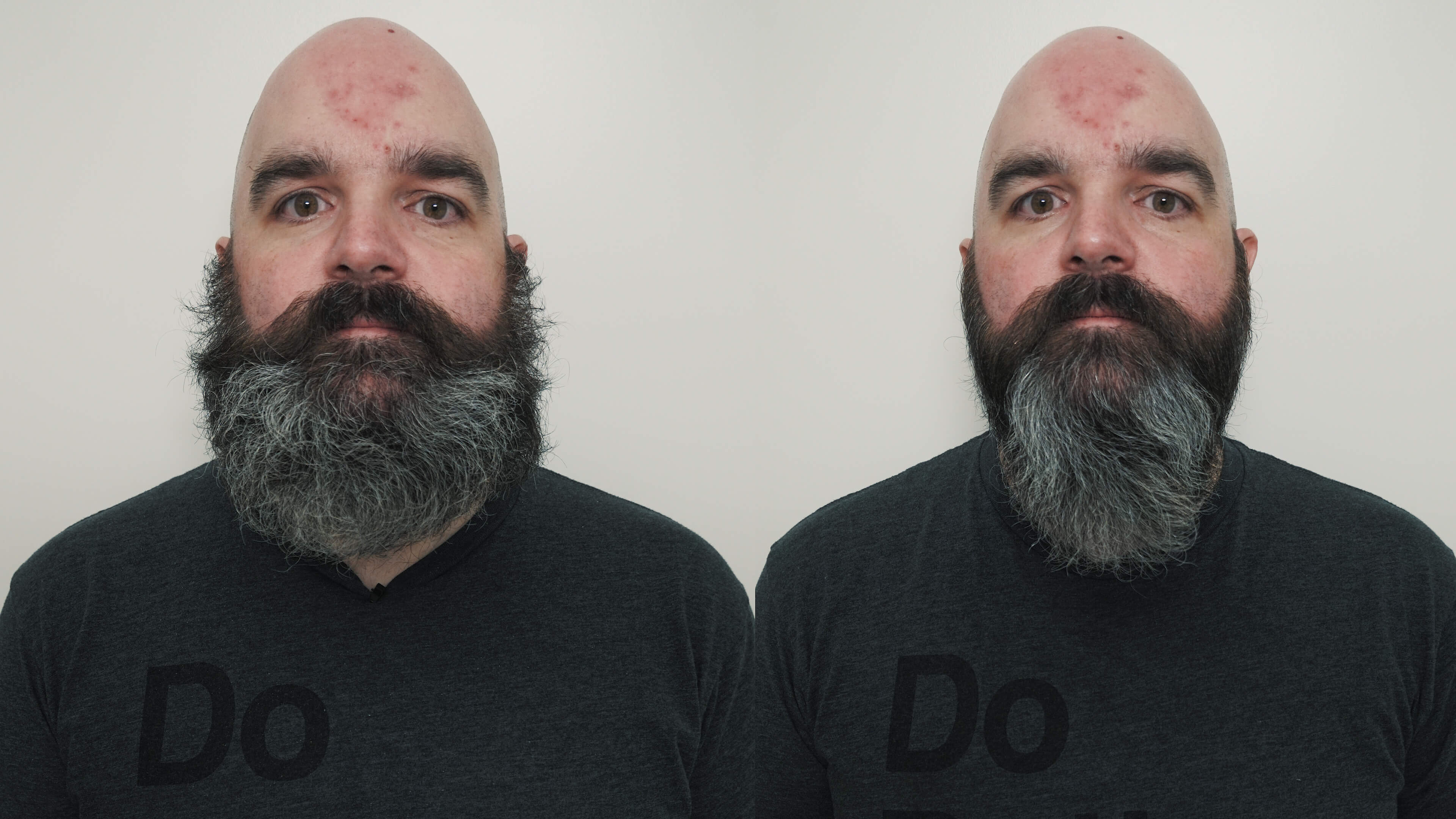 beard getting curly
