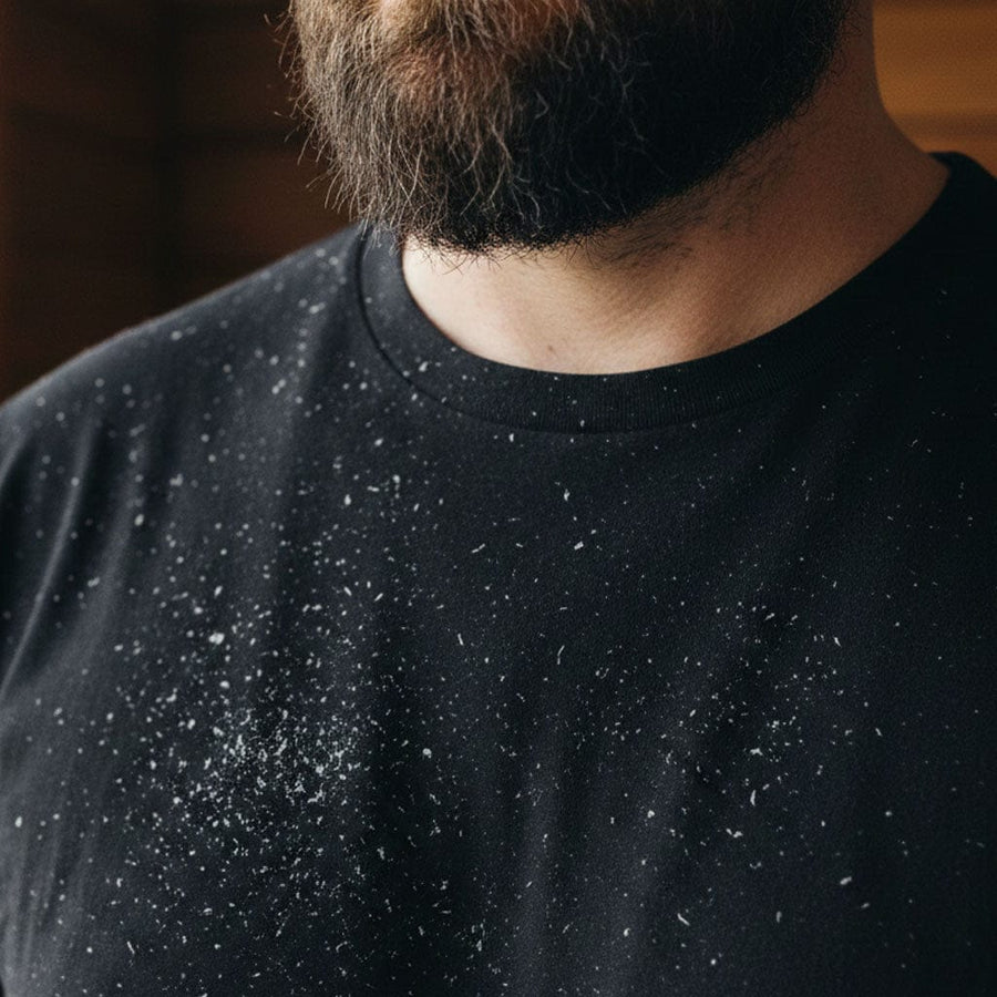 2) The Embarrassing Snowstorm On Your Shirt