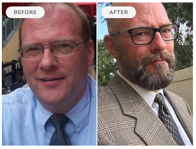 Before and after