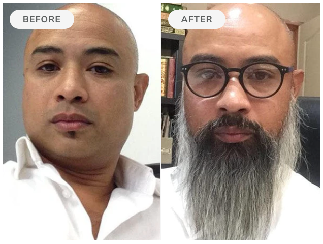 Before and after