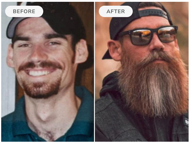 Before and after