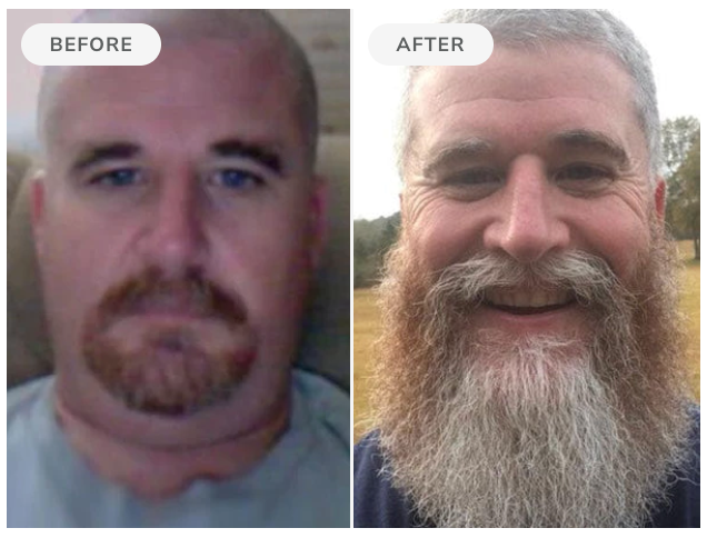 Before and after