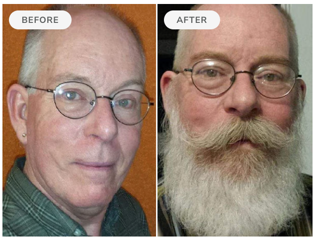 Before and after