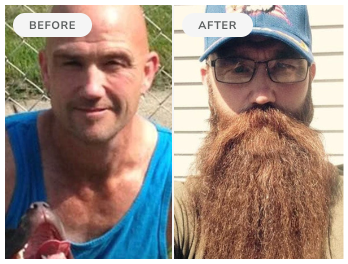 Before and after