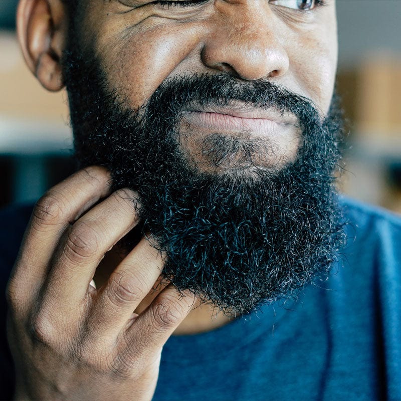 1) Beard Itch That Drives You Crazy