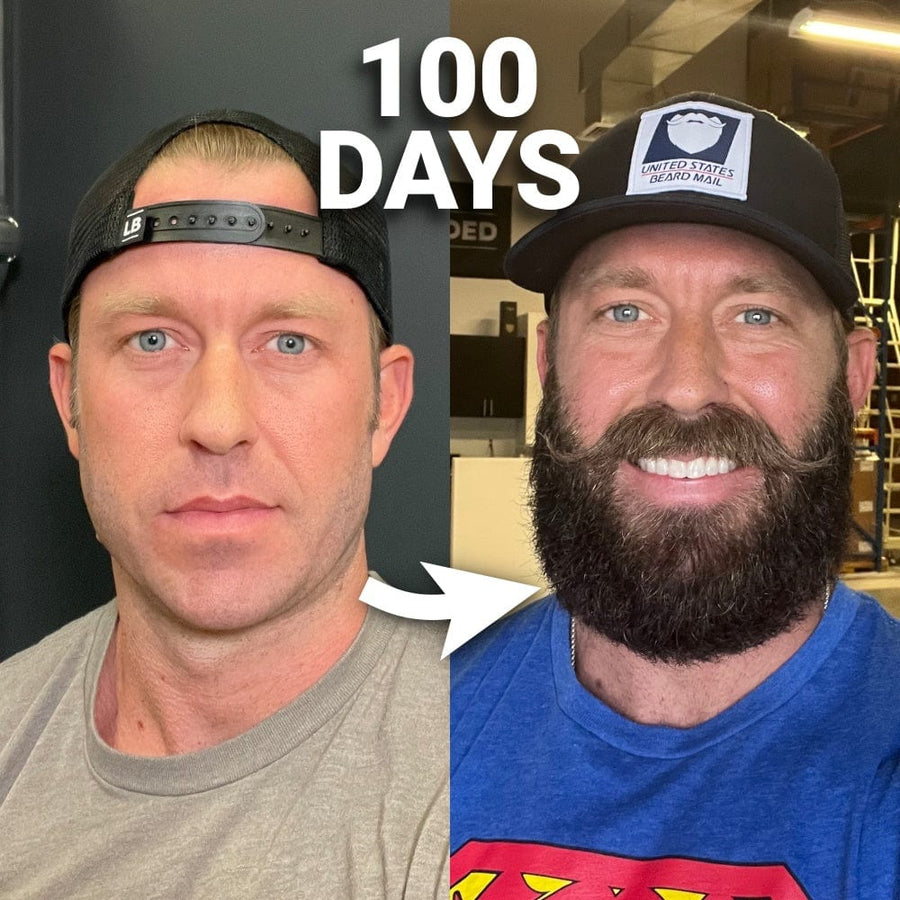 5. You've Never Used Beard Boost